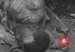 Image of USA soldier burn victim treated WW2 Saint Lo France, 1944, second 60 stock footage video 65675079320
