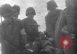Image of Normandy invasion wounded WW2 Normandy France, 1944, second 12 stock footage video 65675079432