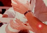 Image of US Army doctors treating leg Vietnam, 1967, second 14 stock footage video 65675080307