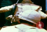 Image of US Army doctors treating leg Vietnam, 1967, second 44 stock footage video 65675080307