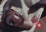Image of Iwo Jima wounded patients Iwo Jima, 1945, second 36 stock footage video 65675080620