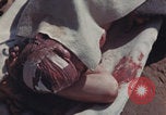 Image of Iwo Jima wounded patients Iwo Jima, 1945, second 38 stock footage video 65675080620