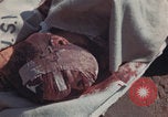 Image of Iwo Jima wounded patients Iwo Jima, 1945, second 45 stock footage video 65675080620