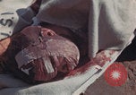 Image of Iwo Jima wounded patients Iwo Jima, 1945, second 46 stock footage video 65675080620