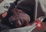 Image of Iwo Jima wounded patients Iwo Jima, 1945, second 50 stock footage video 65675080620
