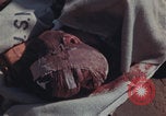 Image of Iwo Jima wounded patients Iwo Jima, 1945, second 51 stock footage video 65675080620
