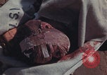 Image of Iwo Jima wounded patients Iwo Jima, 1945, second 52 stock footage video 65675080620