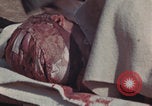 Image of Iwo Jima wounded patients Iwo Jima, 1945, second 53 stock footage video 65675080620