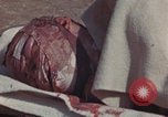 Image of Iwo Jima wounded patients Iwo Jima, 1945, second 55 stock footage video 65675080620