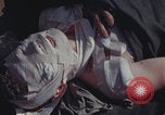 Image of US Marines wounded Iwo Jima, 1945, second 30 stock footage video 65675080624
