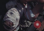 Image of US Marines wounded Iwo Jima, 1945, second 32 stock footage video 65675080624