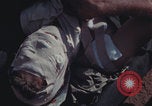 Image of US Marines wounded Iwo Jima, 1945, second 33 stock footage video 65675080624