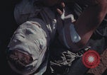 Image of US Marines wounded Iwo Jima, 1945, second 34 stock footage video 65675080624
