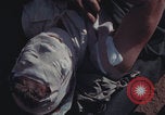 Image of US Marines wounded Iwo Jima, 1945, second 35 stock footage video 65675080624