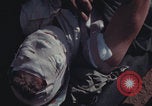 Image of US Marines wounded Iwo Jima, 1945, second 36 stock footage video 65675080624