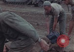 Image of Iwo Jima blood transfusion Iwo Jima, 1945, second 13 stock footage video 65675080625