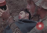Image of Iwo Jima blood transfusion Iwo Jima, 1945, second 38 stock footage video 65675080625