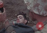 Image of Iwo Jima blood transfusion Iwo Jima, 1945, second 41 stock footage video 65675080625