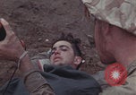 Image of Iwo Jima blood transfusion Iwo Jima, 1945, second 45 stock footage video 65675080625