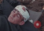 Image of Iwo Jima blood transfusion Iwo Jima, 1945, second 47 stock footage video 65675080625