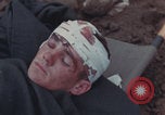 Image of Iwo Jima blood transfusion Iwo Jima, 1945, second 48 stock footage video 65675080625