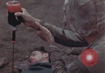Image of Iwo Jima blood transfusion Iwo Jima, 1945, second 50 stock footage video 65675080625