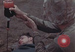 Image of Iwo Jima blood transfusion Iwo Jima, 1945, second 52 stock footage video 65675080625
