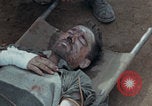 Image of Injured and deceased Marines WW2 Iwo Jima Japan, 1945, second 12 stock footage video 65675080805