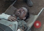 Image of Injured and deceased Marines WW2 Iwo Jima Japan, 1945, second 13 stock footage video 65675080805