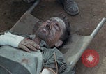 Image of Injured and deceased Marines WW2 Iwo Jima Japan, 1945, second 14 stock footage video 65675080805